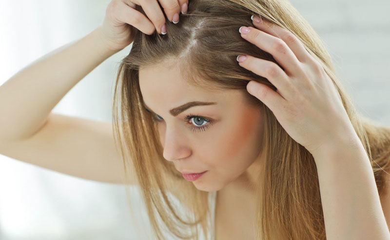 Top 10 Hair fall treatment for Women