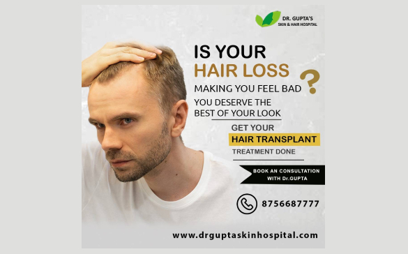 Hair Transplant in Lucknow